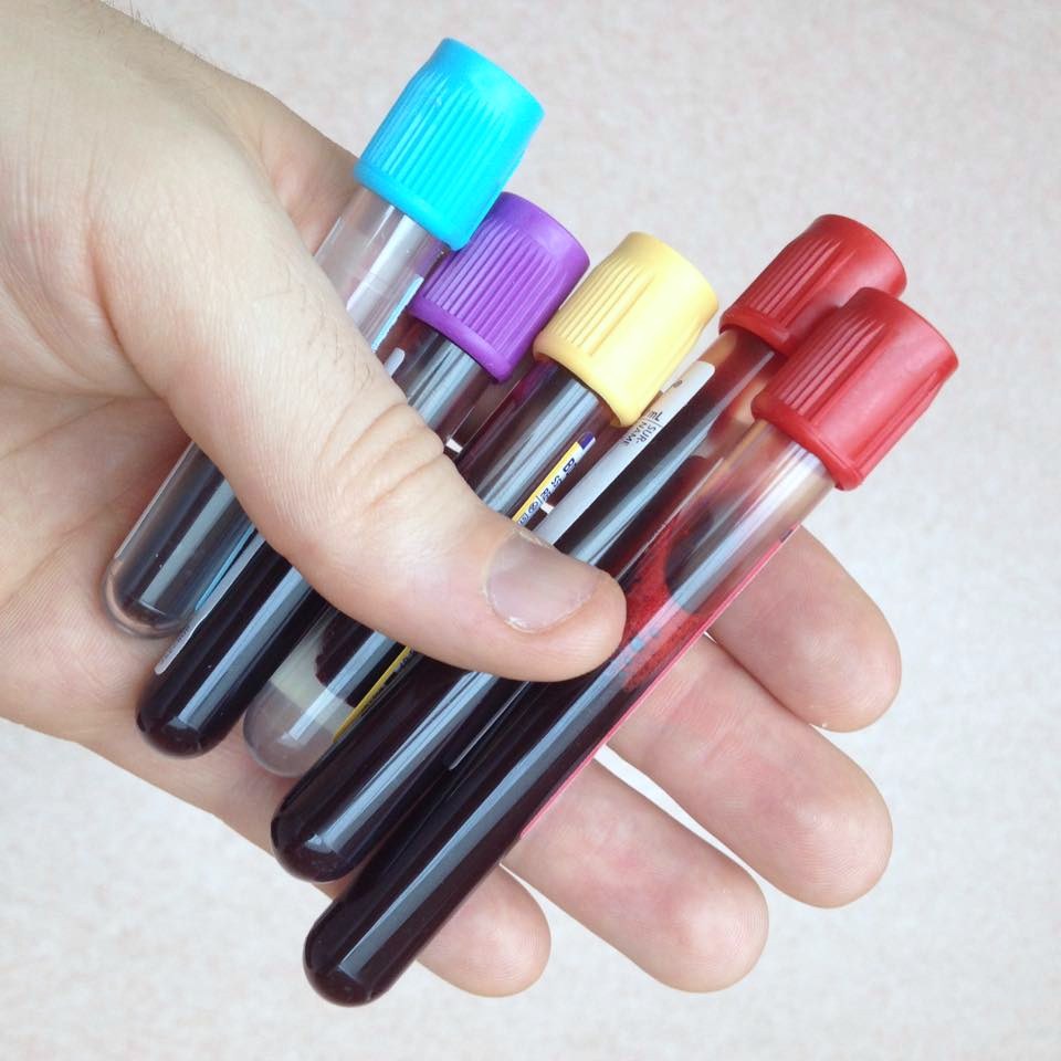 Test tubes full of blood